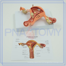 PNT-0742 Modelo natural humano personalizado do útero com alta qualidade